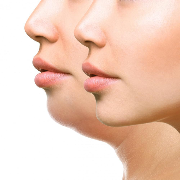 products-image